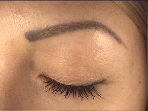 Laserowe usuwanie makijażu permanentnego i tatuaży